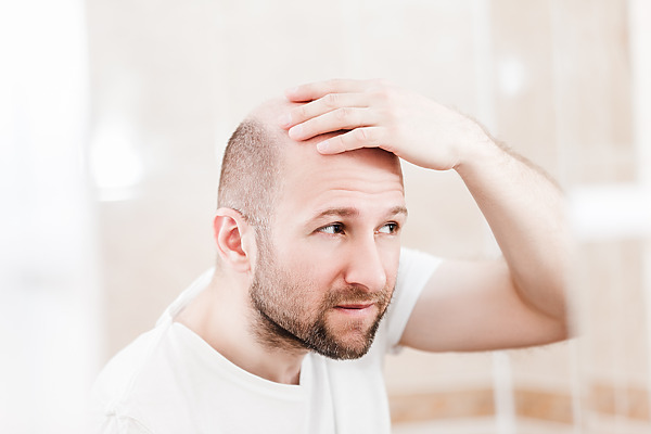 Does Low Testosterone Cause Hair Loss? Signs, Symptoms and Treatment, Wimpole Clinic