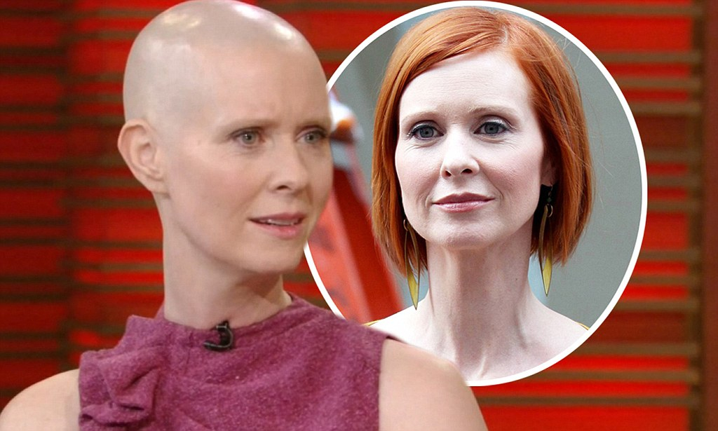 Cynthia Nixon bald and with hair