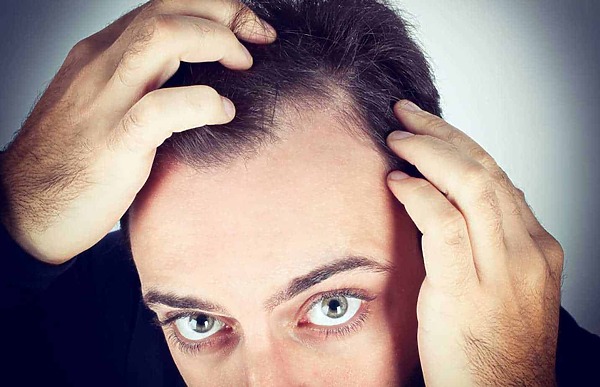 3-hair-loss-symptoms-you-shouldn't-ignore