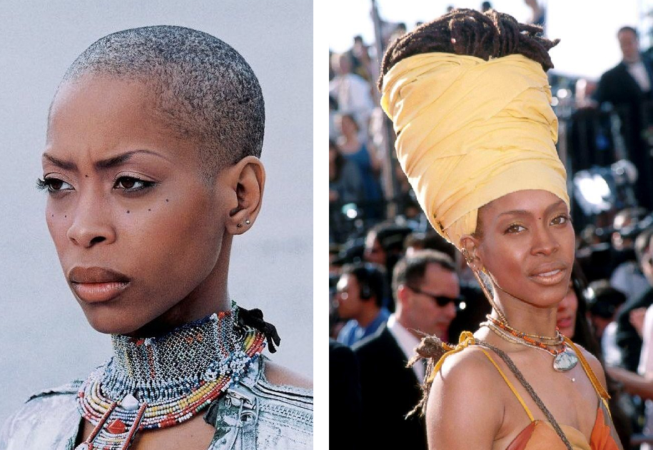 29 Bold Bald Women Who Rocked A Shaved Head, Wimpole Clinic