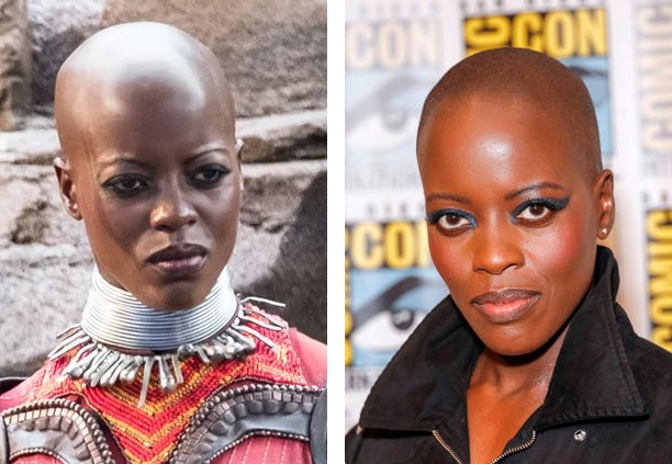 29 Bold Bald Women Who Rocked A Shaved Head, Wimpole Clinic