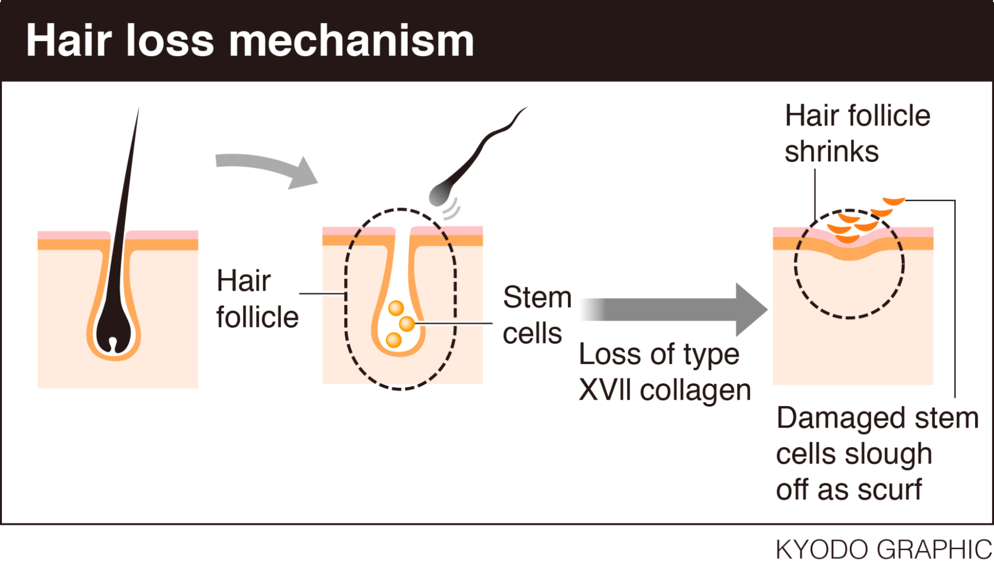 Does Collagen Help Hair Growth? 2023 Expert Review, Wimpole Clinic