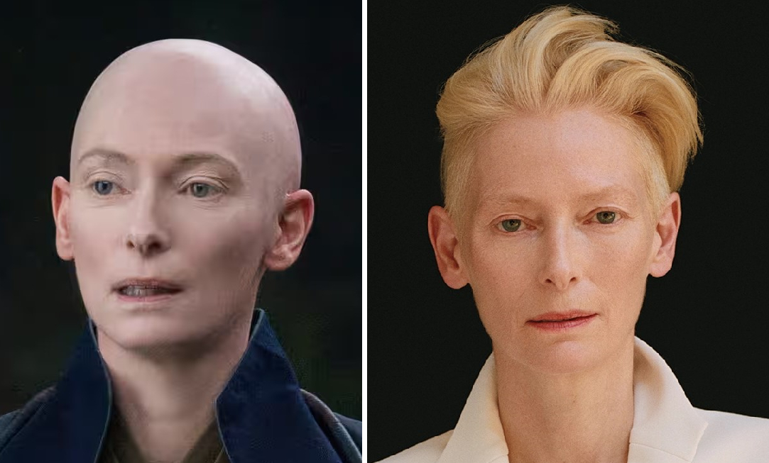 29 Bold Bald Women Who Rocked A Shaved Head, Wimpole Clinic