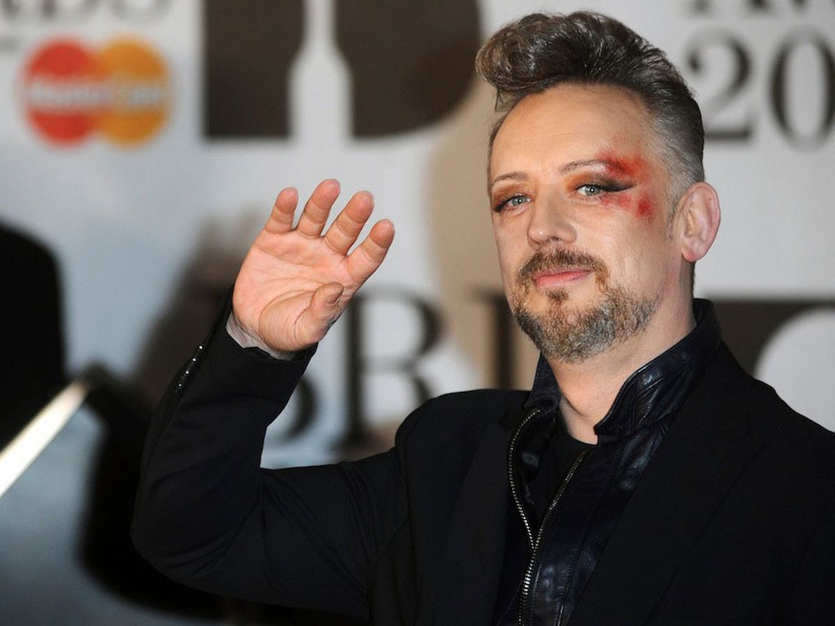 Boy George hair transplant results