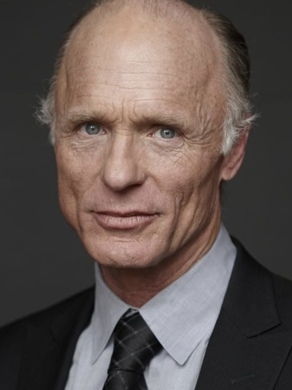 ed harris hair loss norwood stage 6