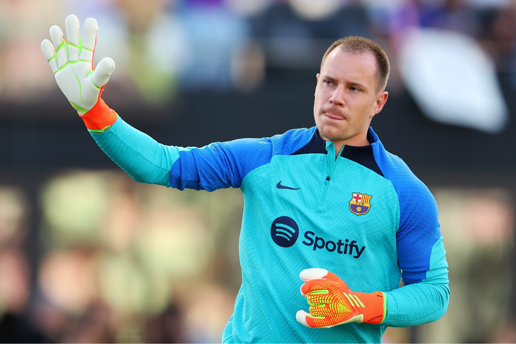 Marc-André ter Stegen Hair Transplant:  Everything You Need to Know, Wimpole Clinic