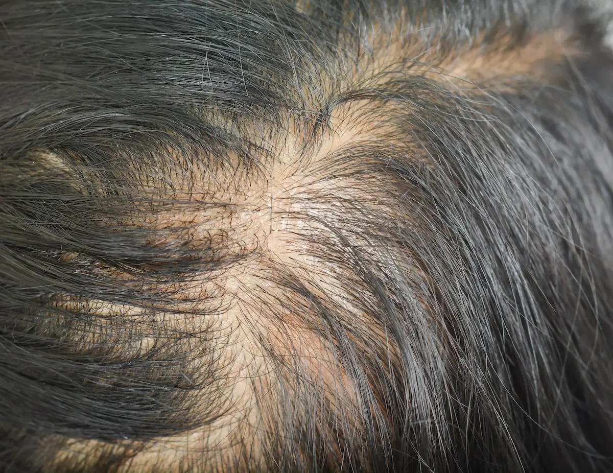 visible scalp through parting